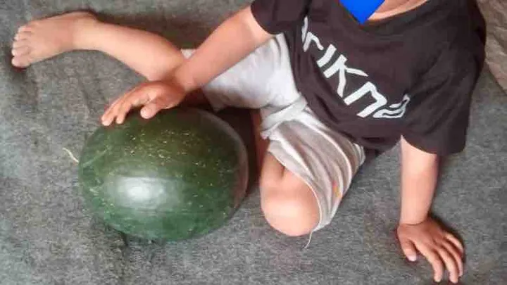Child seated with watermelon, symbolising food scarcity; Gaza child medical aid.
